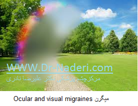 Ocular and visual migraines میگرن 